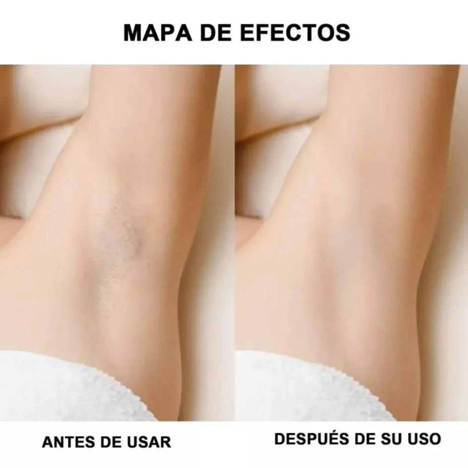 Depilador Skin Yess + 🎁E-book Gratis (Cuidado de la piel)