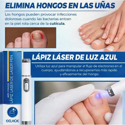 Láser Para Hongos de Uñas + 🎁 E-book gratis de cuidado