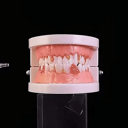 AquaSmile | Irrigador Dental Premium + Blanqueador Premium GRATIS