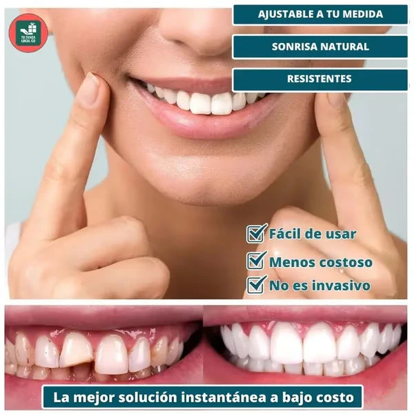 Oferta 2x1: Snap On Smile | Carillas Dentales Premium