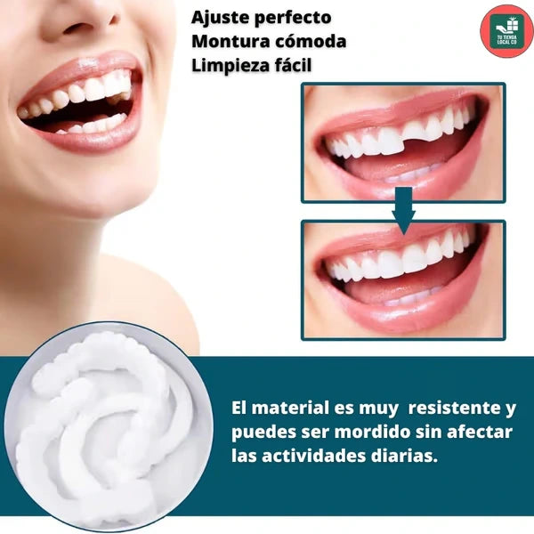 Oferta 2x1: Snap On Smile | Carillas Dentales Premium